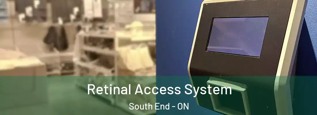  Retinal Access System South End - ON